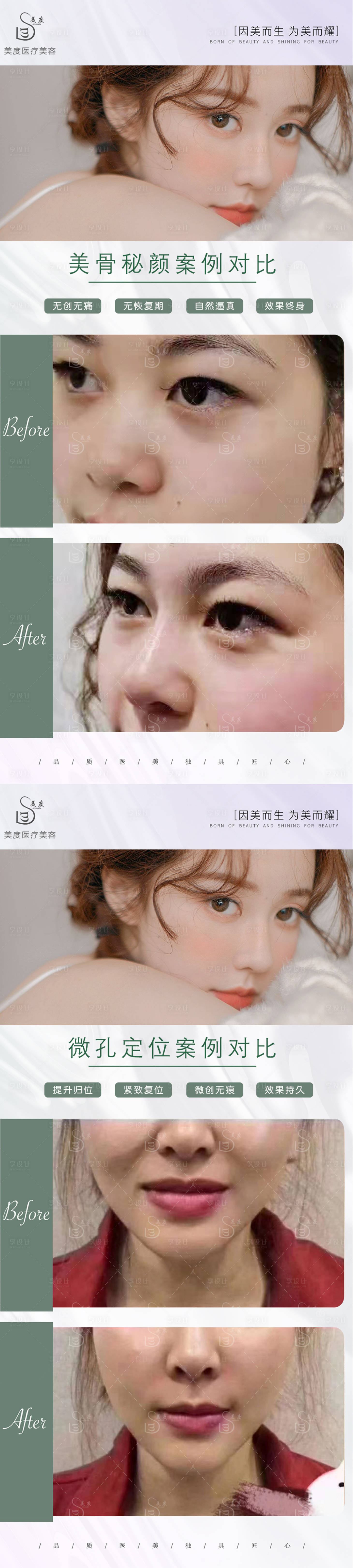 源文件下载【享设计】搜索编号：60080011236277112【医美案例对比图】