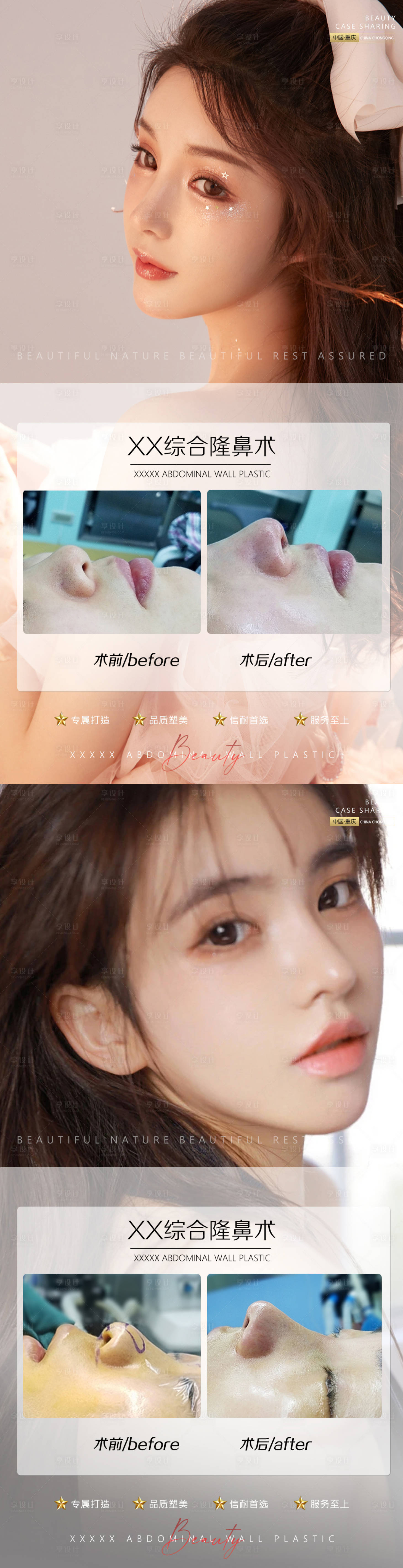 源文件下载【医美案例鼻子系列海报】编号：92620011073665765