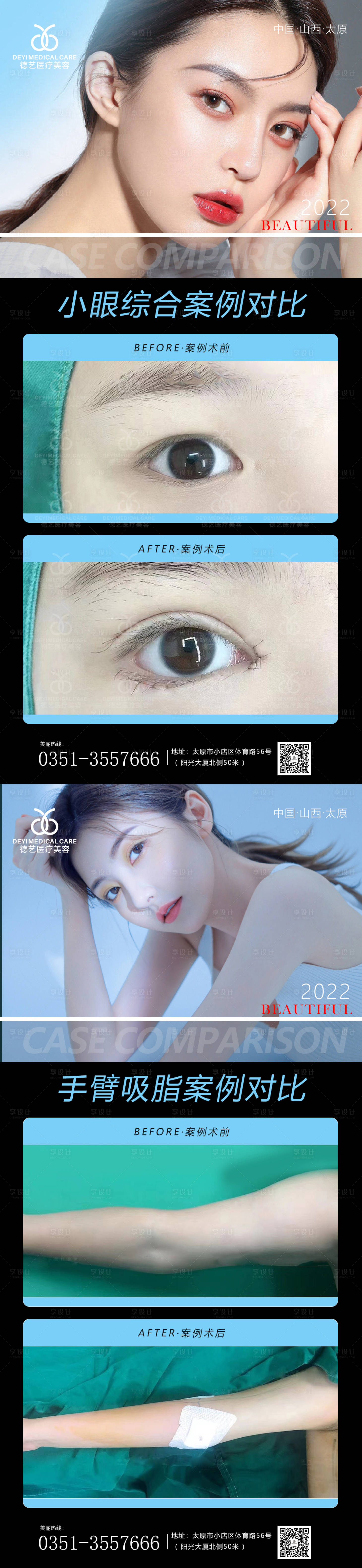 源文件下載【享設計】搜索編號：23800011393871022【醫美案例對比圖】