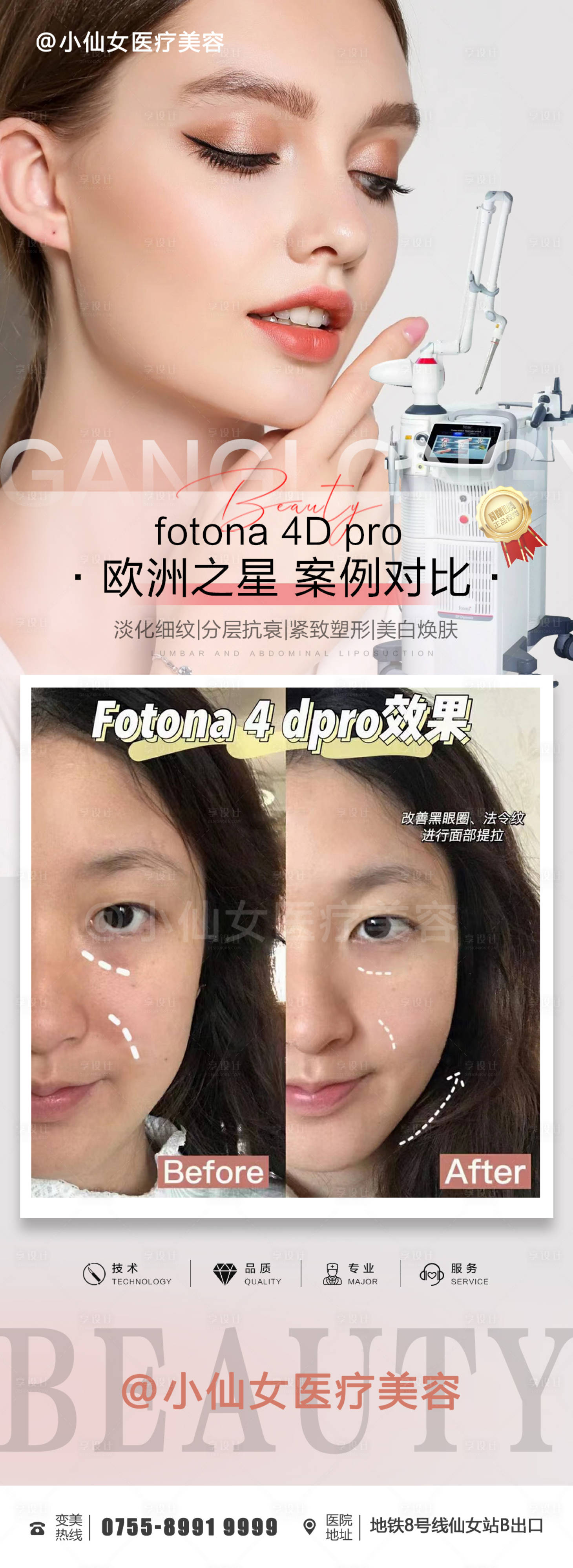 源文件下载【医美案例海报】编号：25690011806776947