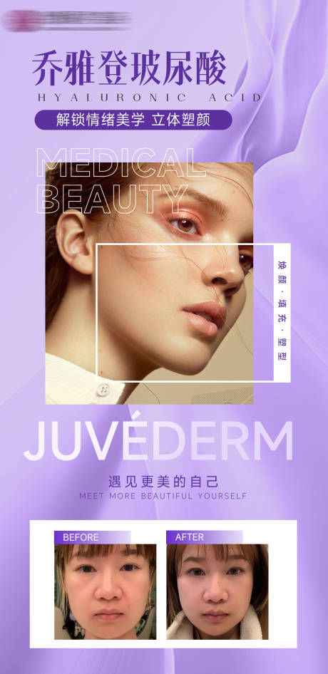 源文件下载【医美乔雅登玻尿酸宣传手机海报】编号：10760011864533854
