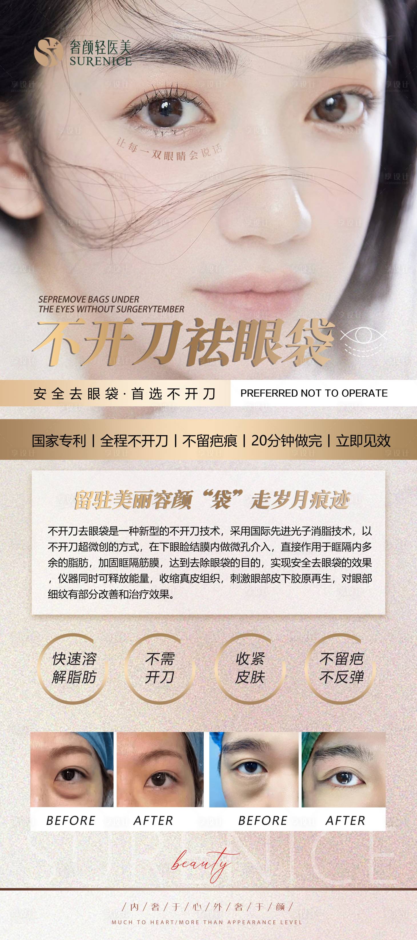 源文件下载【享设计】搜索编号：21760011734668250【医美无痕眼袋展架】