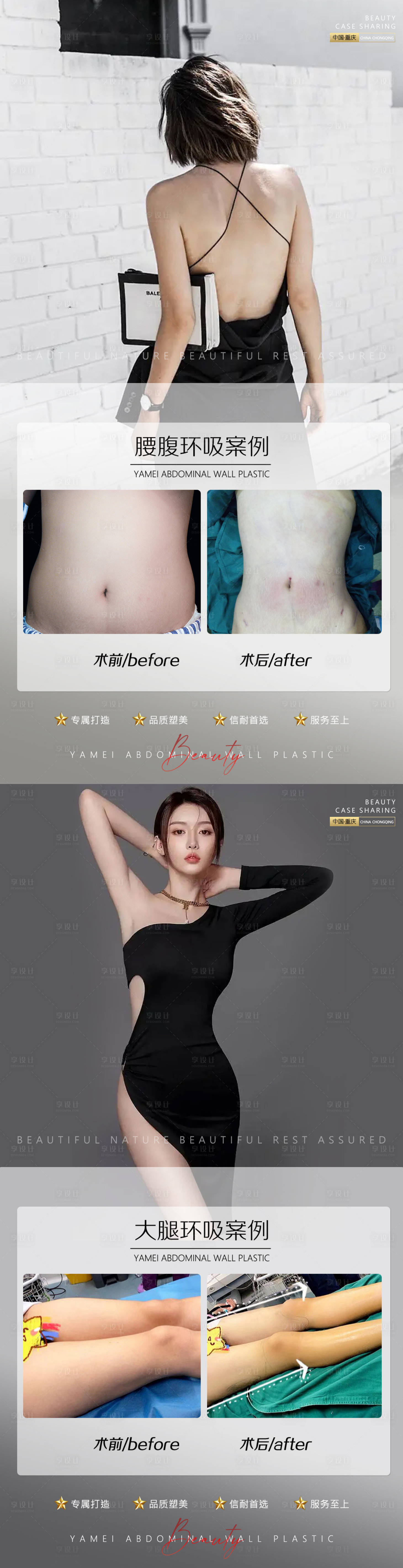 源文件下載【享設計】搜索編號：67770011834145550【案例腰腹環吸大腿環吸0824】
