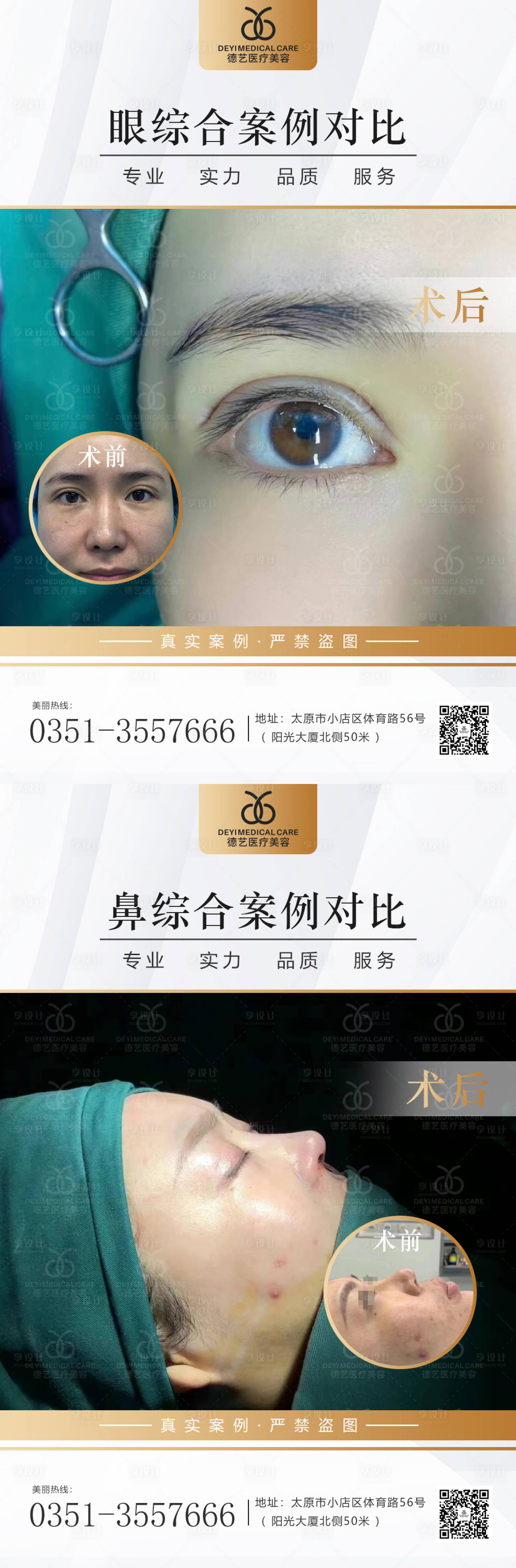 源文件下載【享設計】搜索編號：46000011505393834【醫美案例對比圖】