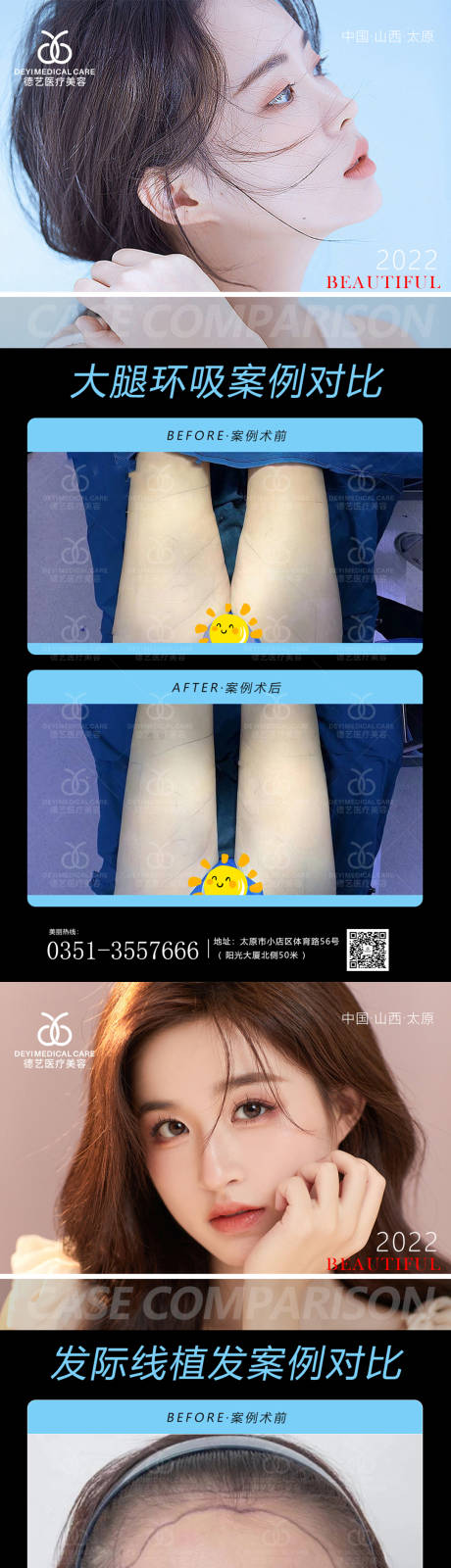 源文件下载【医美案例对比图】编号：25520011403054609