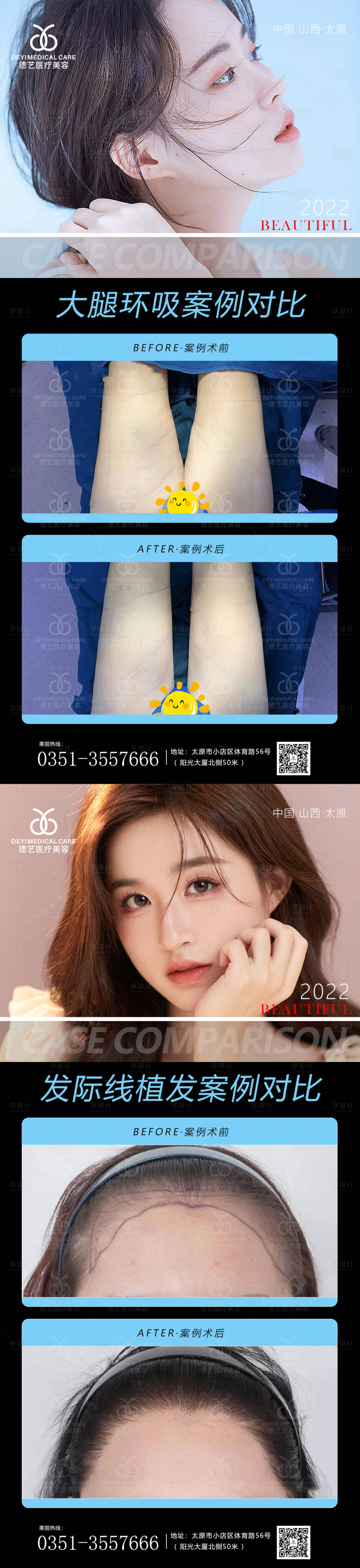 源文件下載【享設(shè)計(jì)】搜索編號(hào)：25520011403054609【醫(yī)美案例對(duì)比圖】