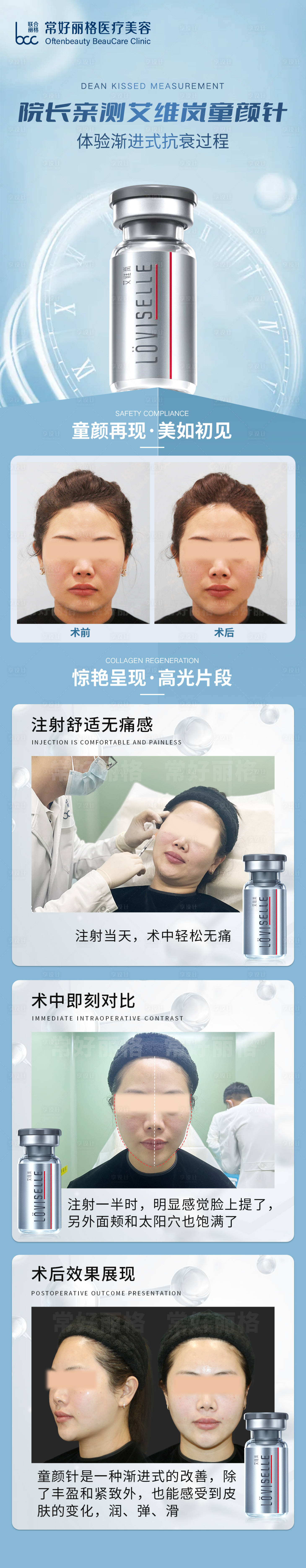 源文件下载【享设计】搜索编号：21740011964974680【艾维岚童颜针案例】