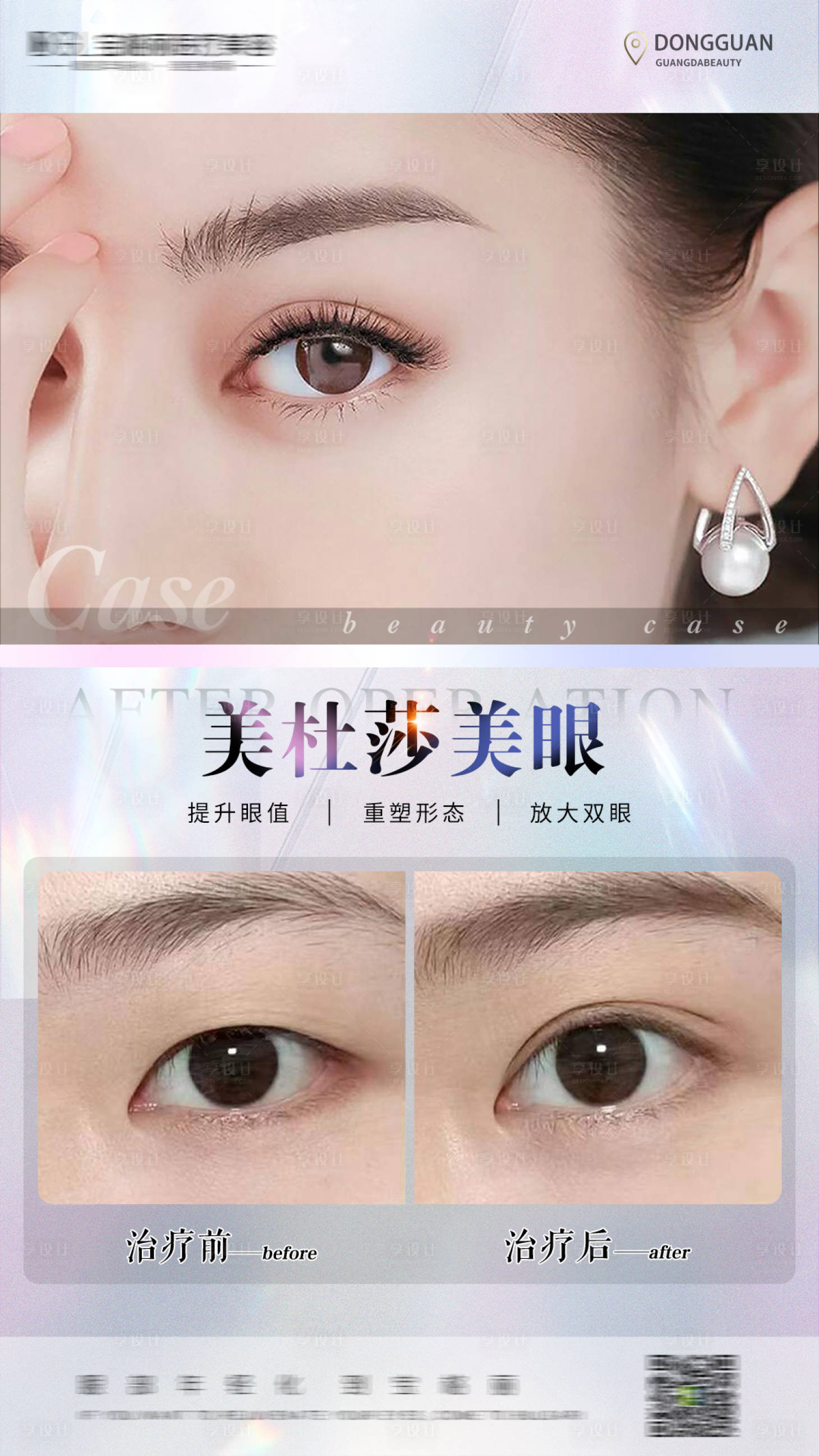 源文件下載【享設計】搜索編號：95000011543408399【醫美案例對比海報】