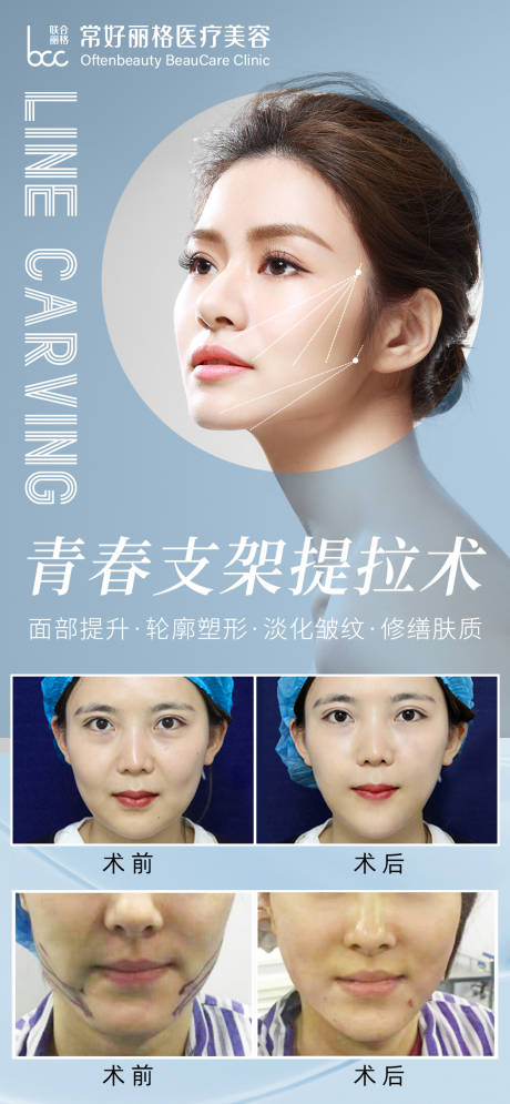 源文件下载【享设计】搜索编号：40110011964268452【线雕案例海报】