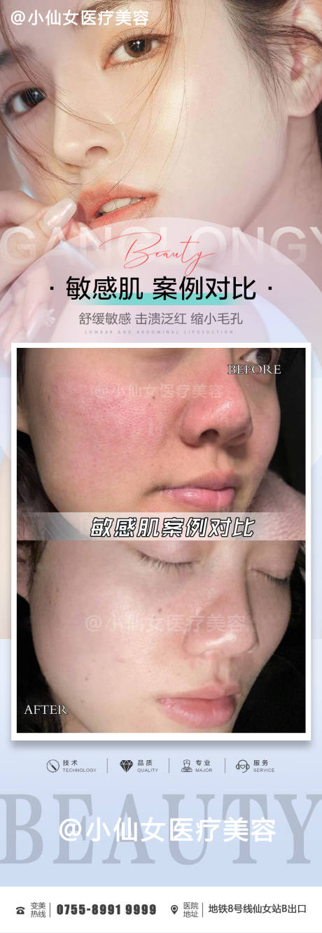 源文件下载【皮肤医美敏感肌案例对比海报】编号：37610011806798887