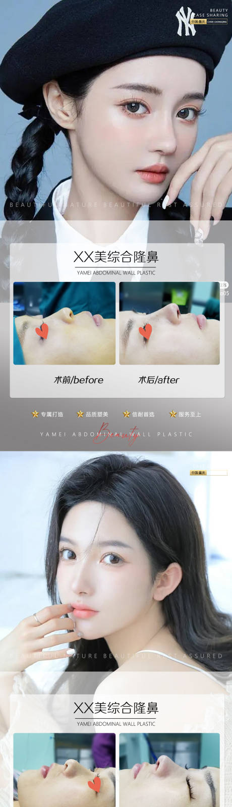 源文件下载【享设计】搜索编号：68810011391425853【医美案例鼻子人物系列海报】