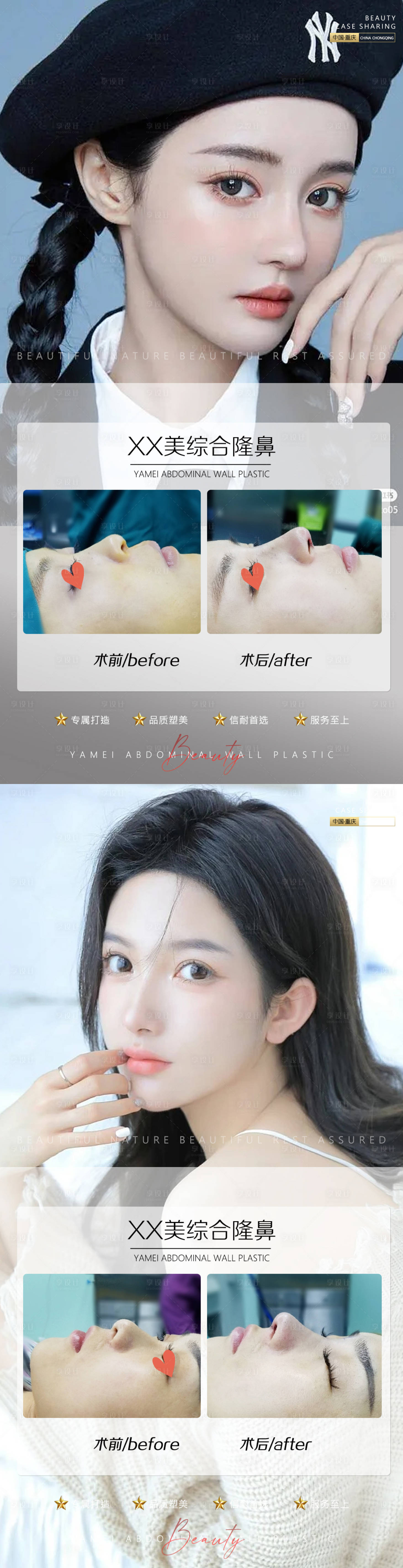 源文件下载【享设计】搜索编号：68810011391425853【医美案例鼻子人物系列海报】