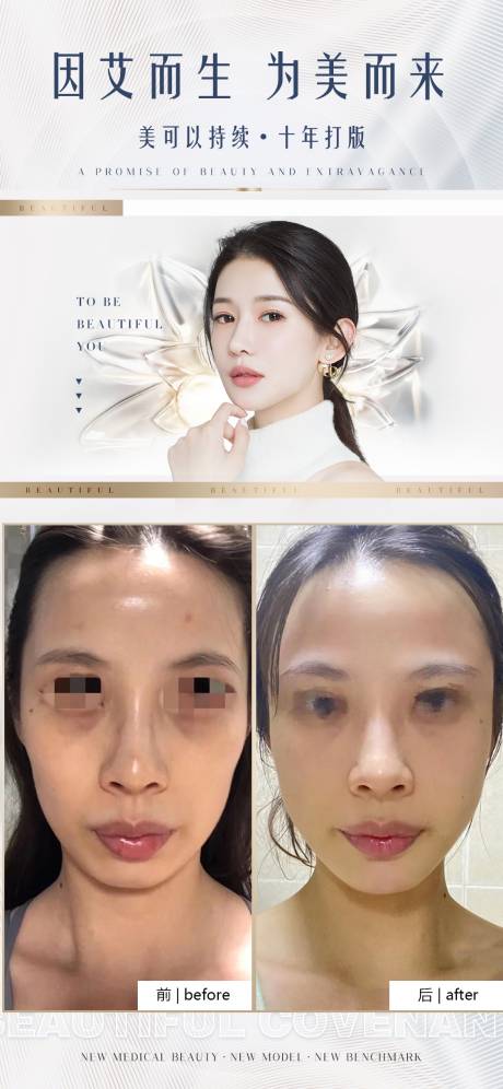 源文件下載【享設計】搜索編號：82860011864743485【醫美案例對比簡約海報】