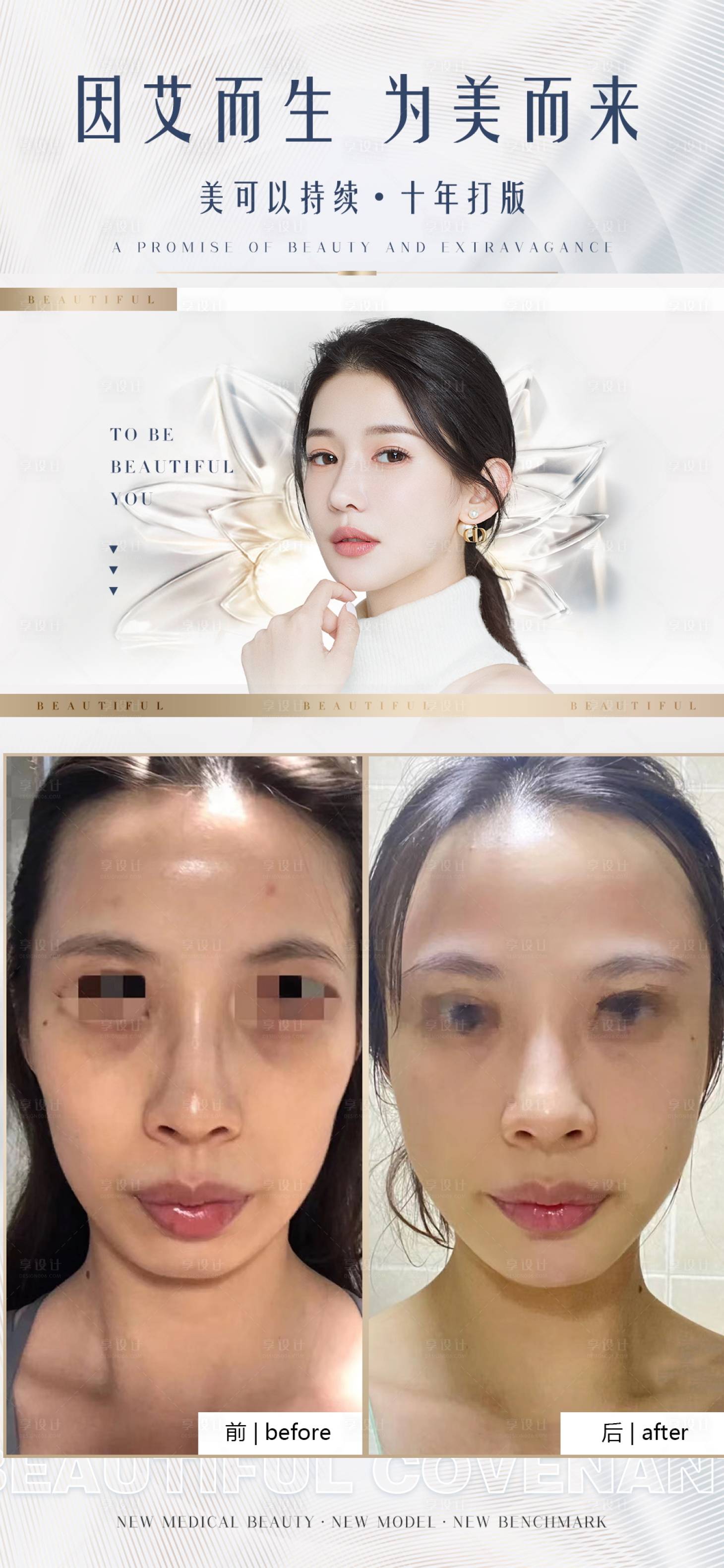 源文件下載【享設計】搜索編號：82860011864743485【醫(yī)美案例對比簡約海報】