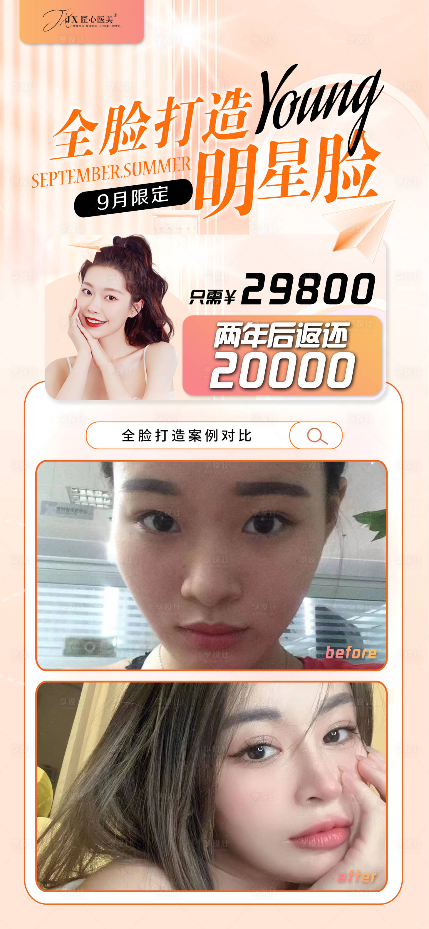 源文件下载【享设计】搜索编号：31150011896966601【医美案例对比图海报圈图】