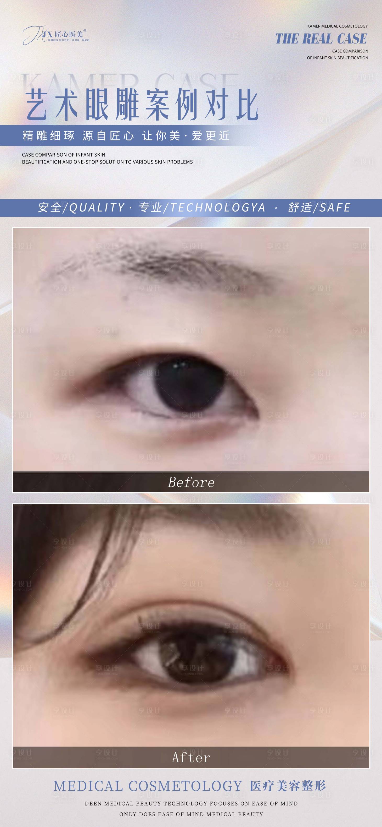 源文件下载【享设计】搜索编号：83690011764688969【医美案例对比海报】