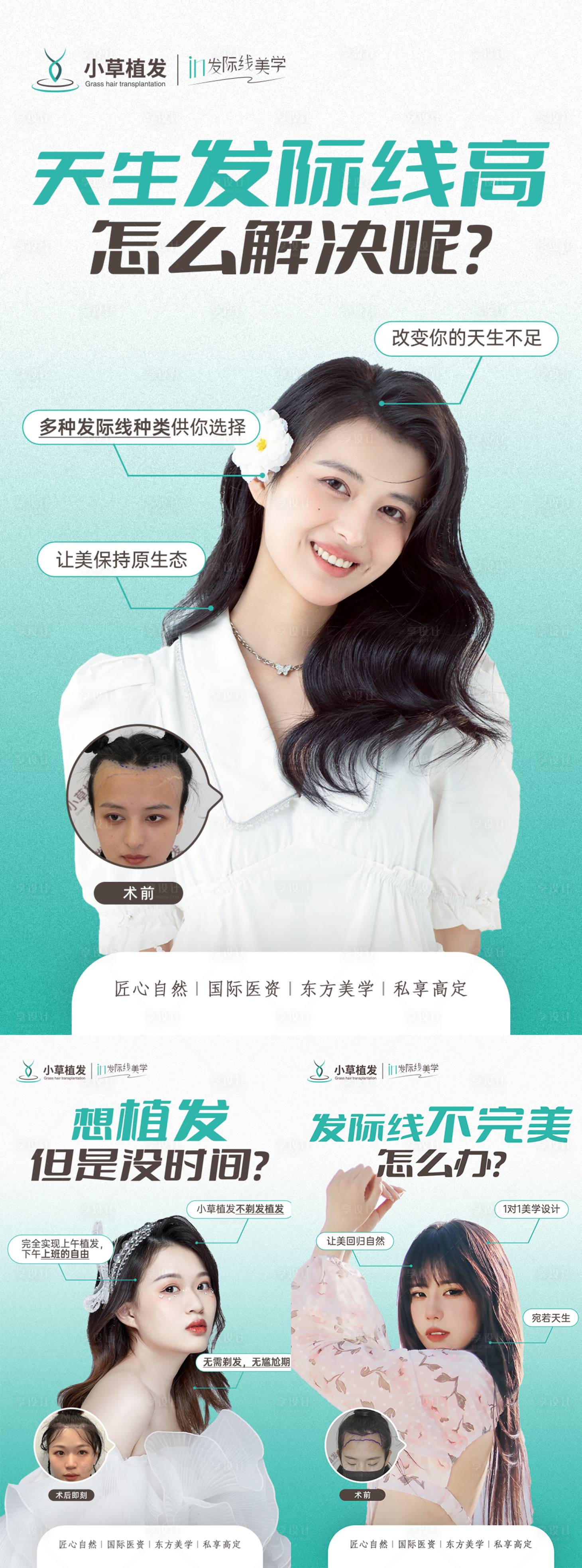 源文件下载【享设计】搜索编号：39800011877999223【医美植发创意海报】