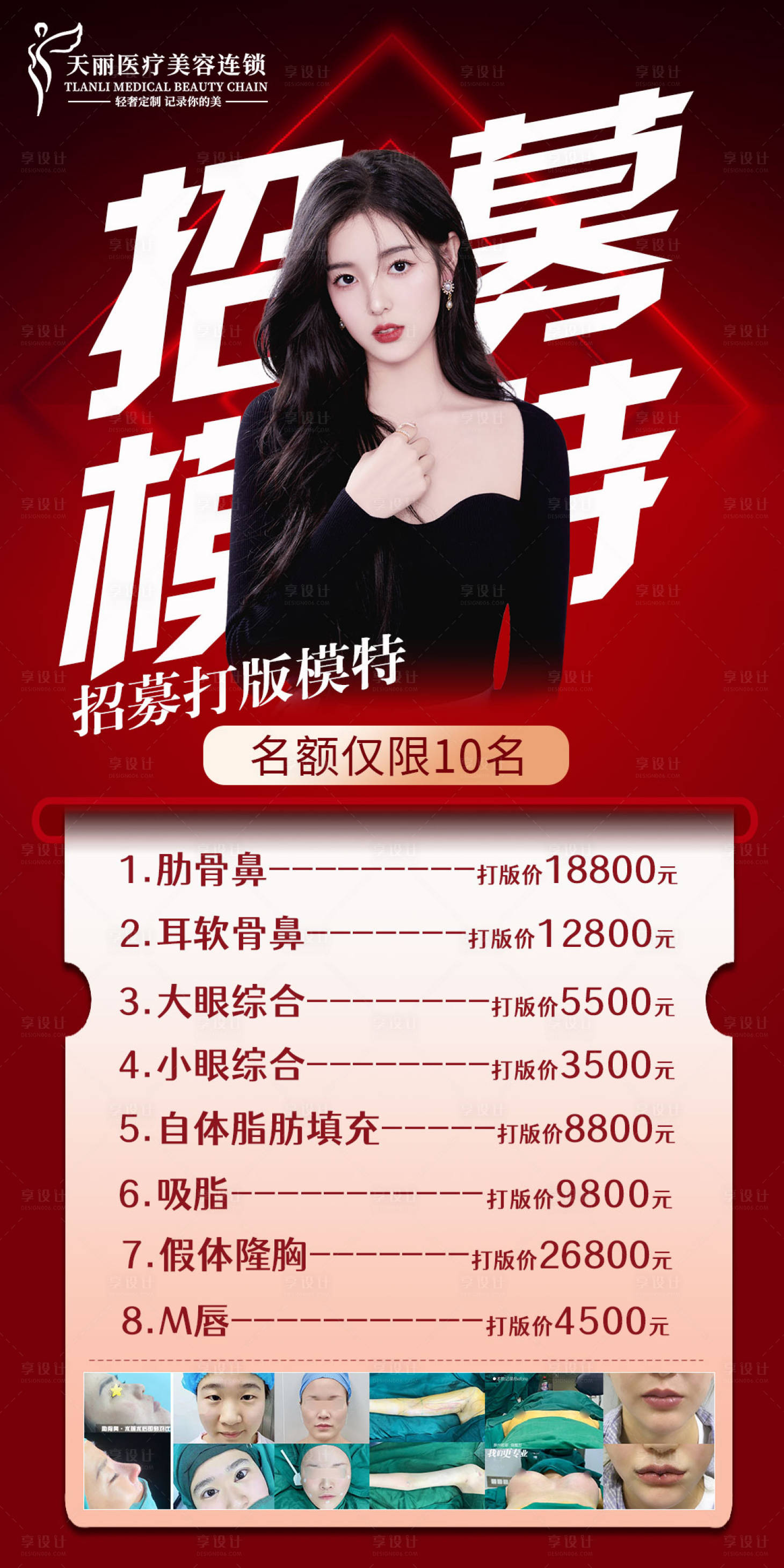 源文件下載【享設計】搜索編號：58920011954935499【醫美模特招募海報】