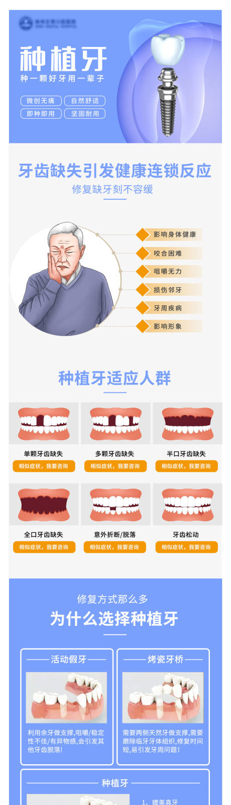 源文件下载【口腔种植牙长图】编号：66700011767062316