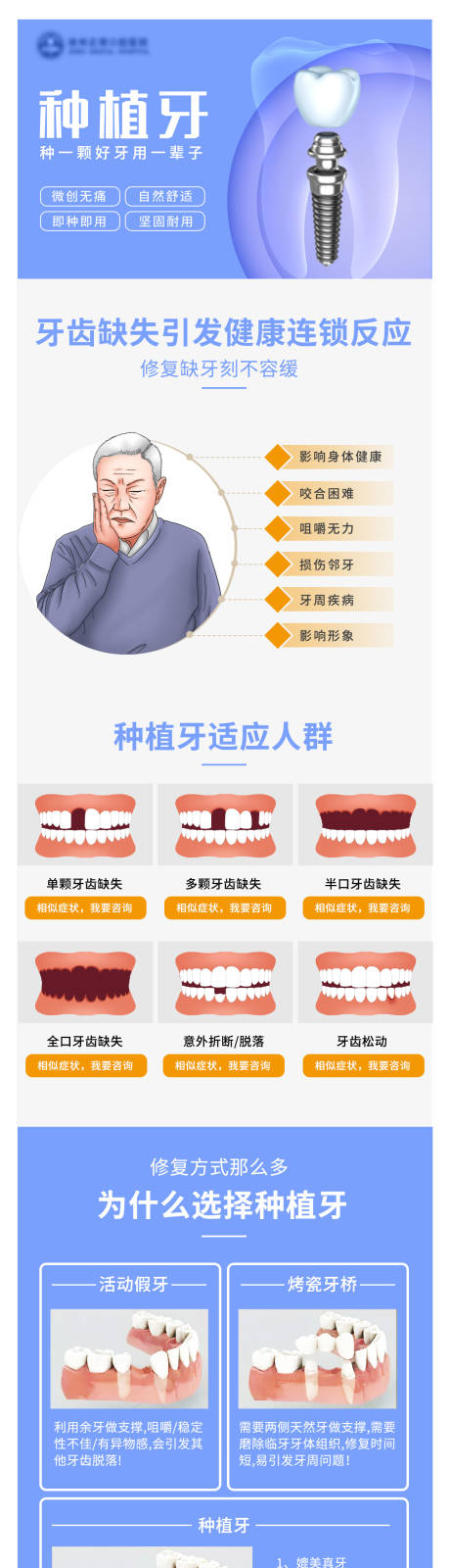 编号：20220821131436699【享设计】源文件下载-口腔种植牙长图
