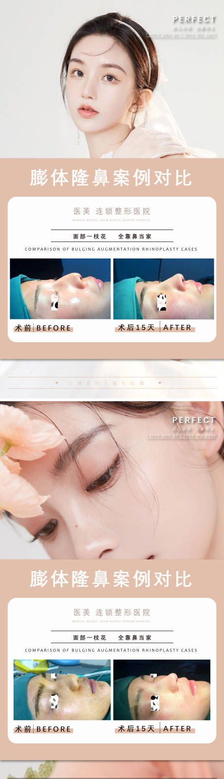 源文件下载【享设计】搜索编号：21010011754464182【医美隆鼻案例海报】