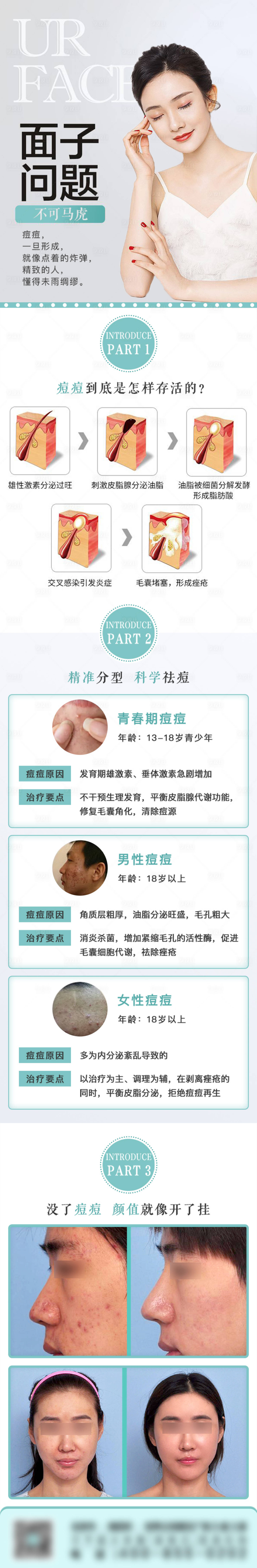 源文件下载【分型祛痘医美长图海报】编号：90360011864433812