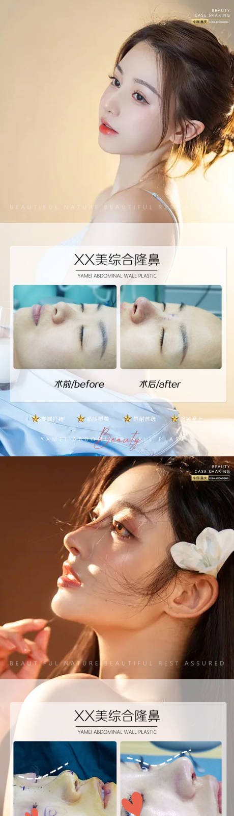 源文件下載【享設計】搜索編號：59350011457914285【醫美案例鼻子海報】