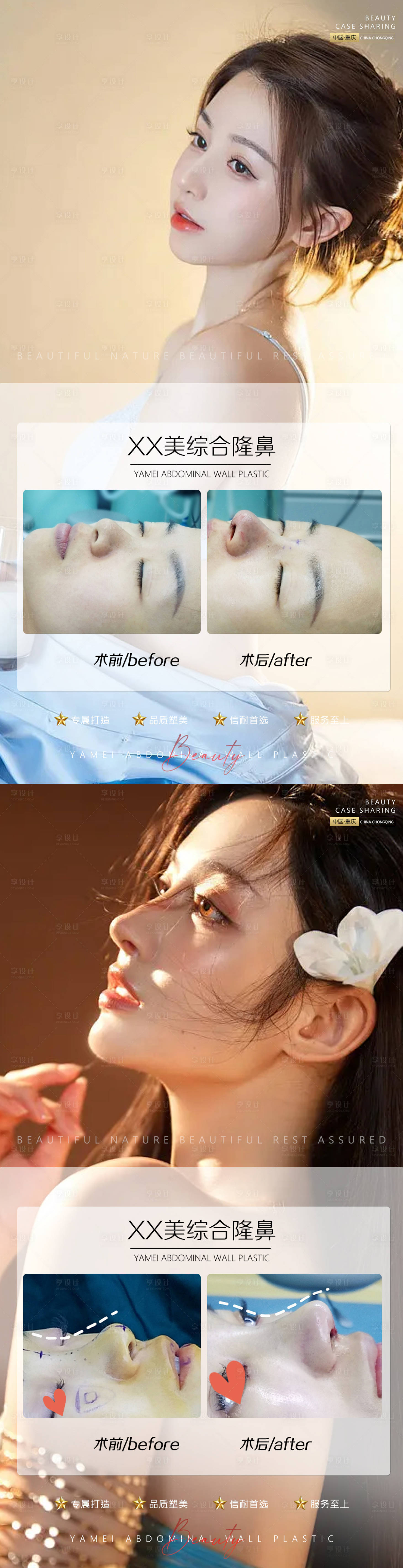 源文件下載【享設(shè)計(jì)】搜索編號：59350011457914285【醫(yī)美案例鼻子海報(bào)】
