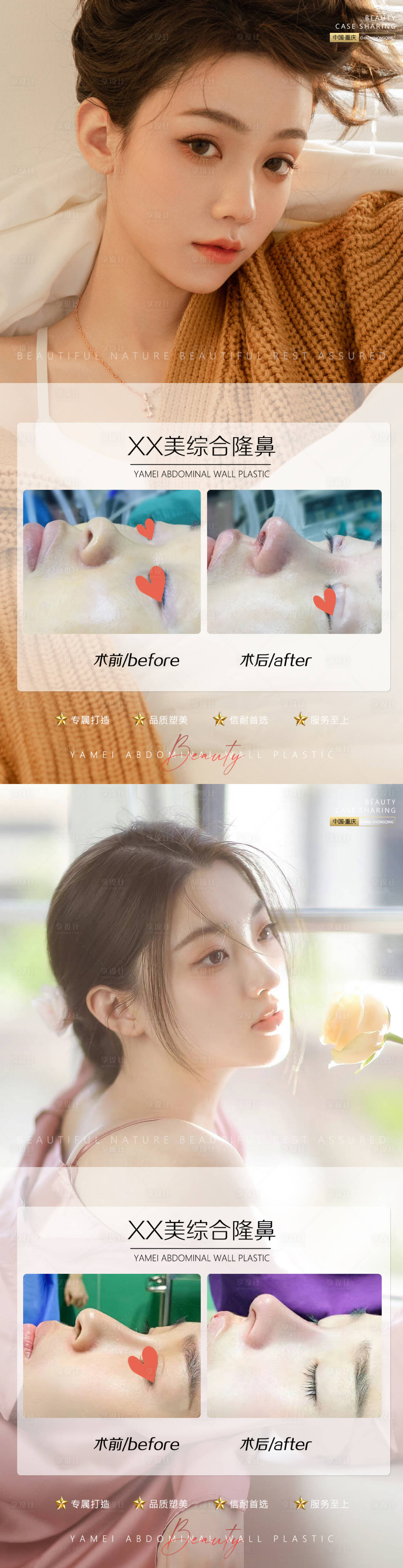 源文件下載【享設(shè)計】搜索編號：23570011587291624【醫(yī)美案例鼻子】