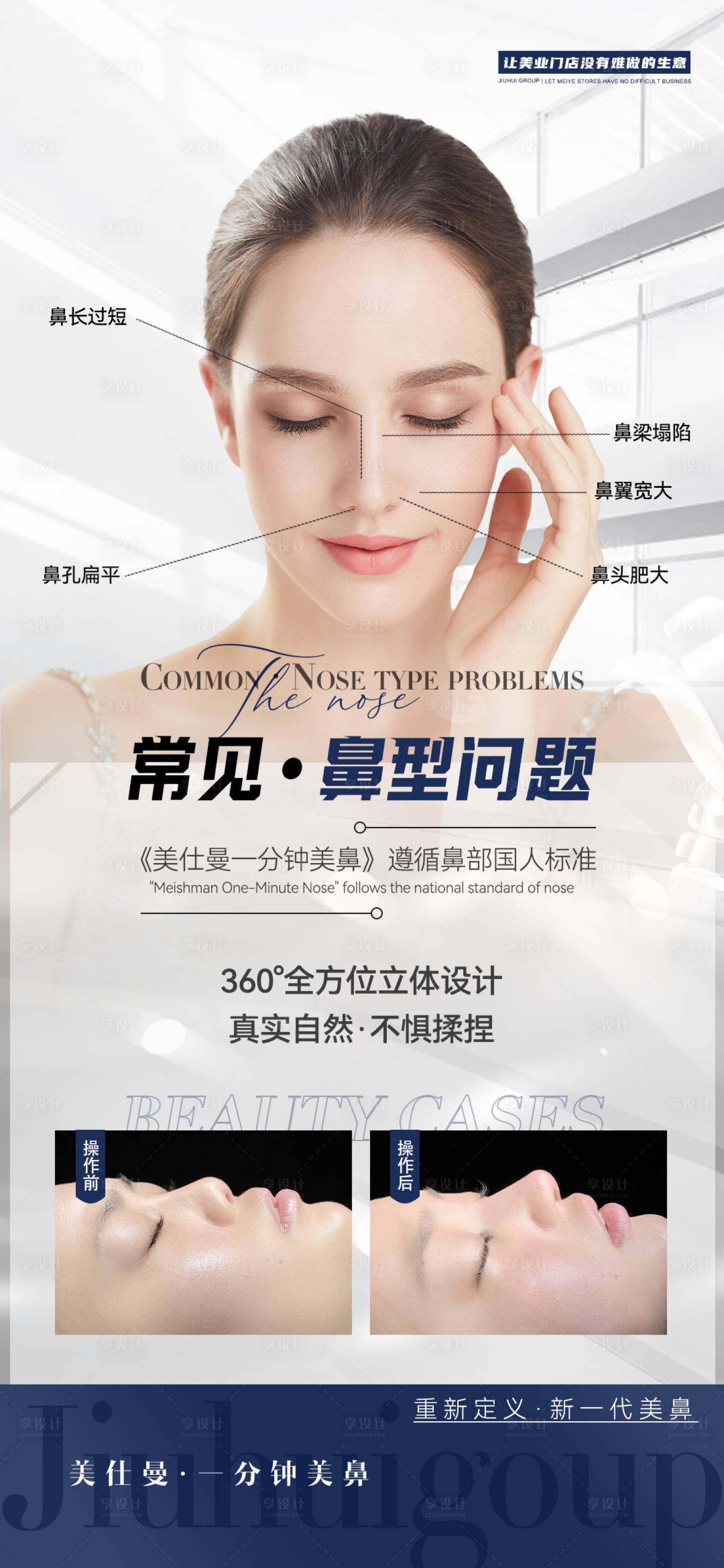 源文件下載【享設計】搜索編號：88250011909648533【醫(yī)美美鼻海報】