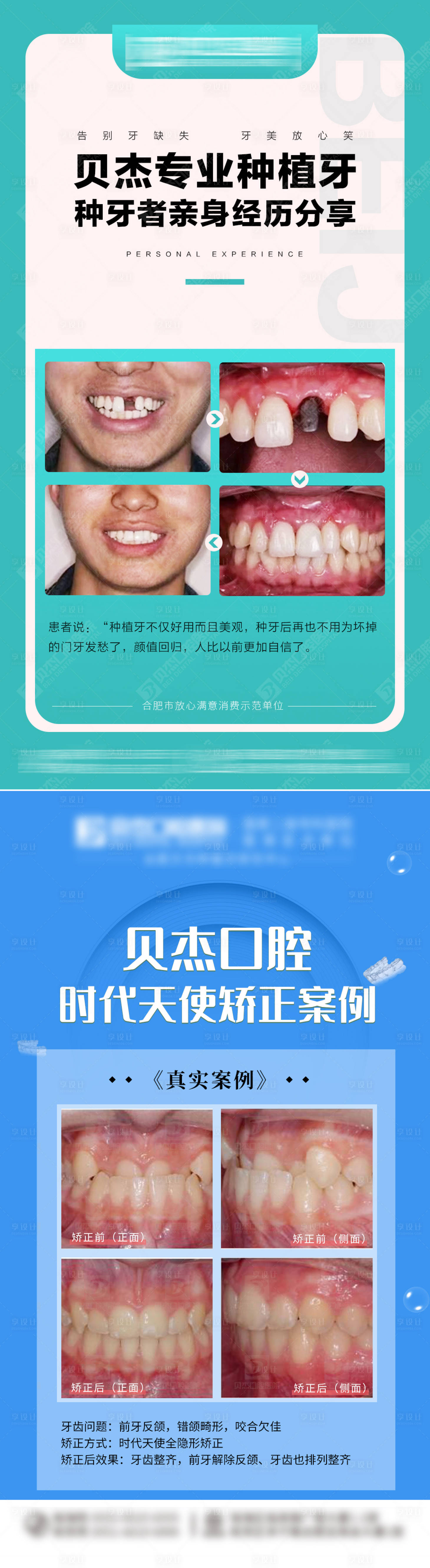 源文件下載【享設計】搜索編號：97150011870465060【種植牙矯正案例系列海報】