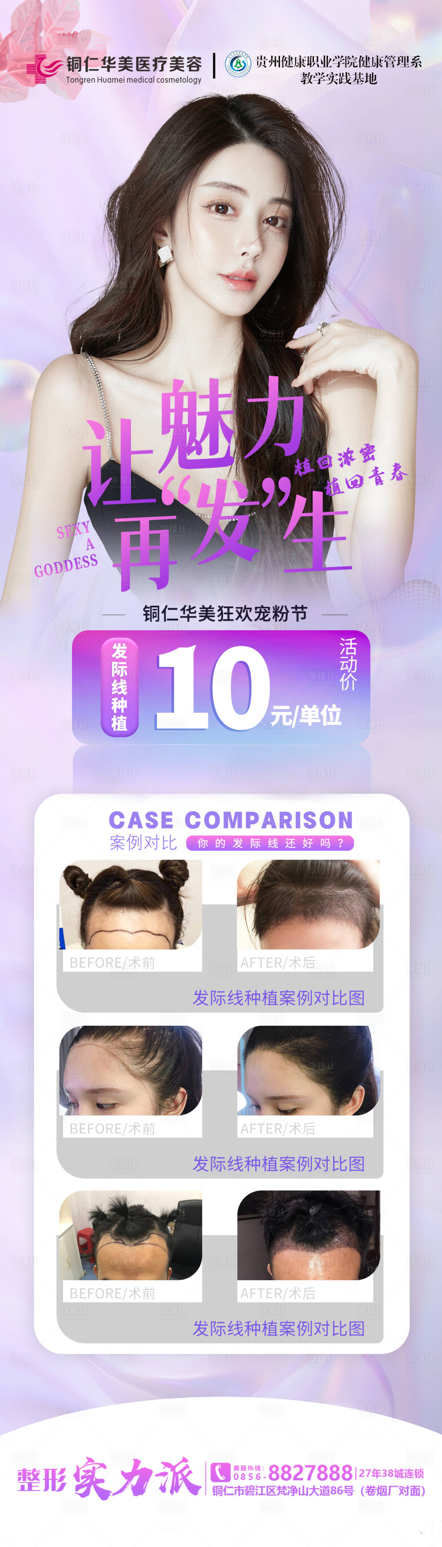 源文件下载【发际线案例 】编号：79350011733702795