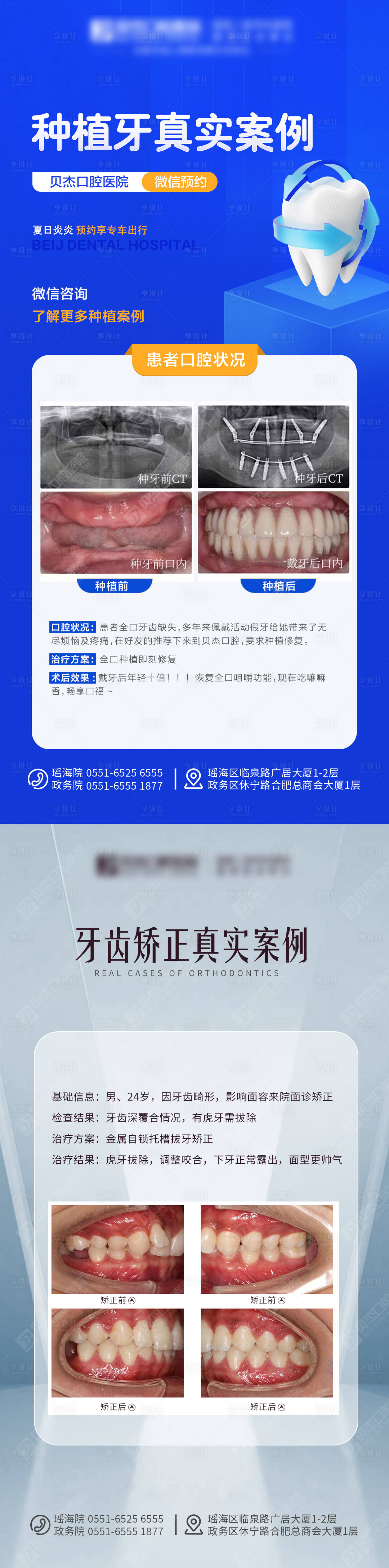 源文件下载【享设计】搜索编号：31930011858802762【口腔案例海报】