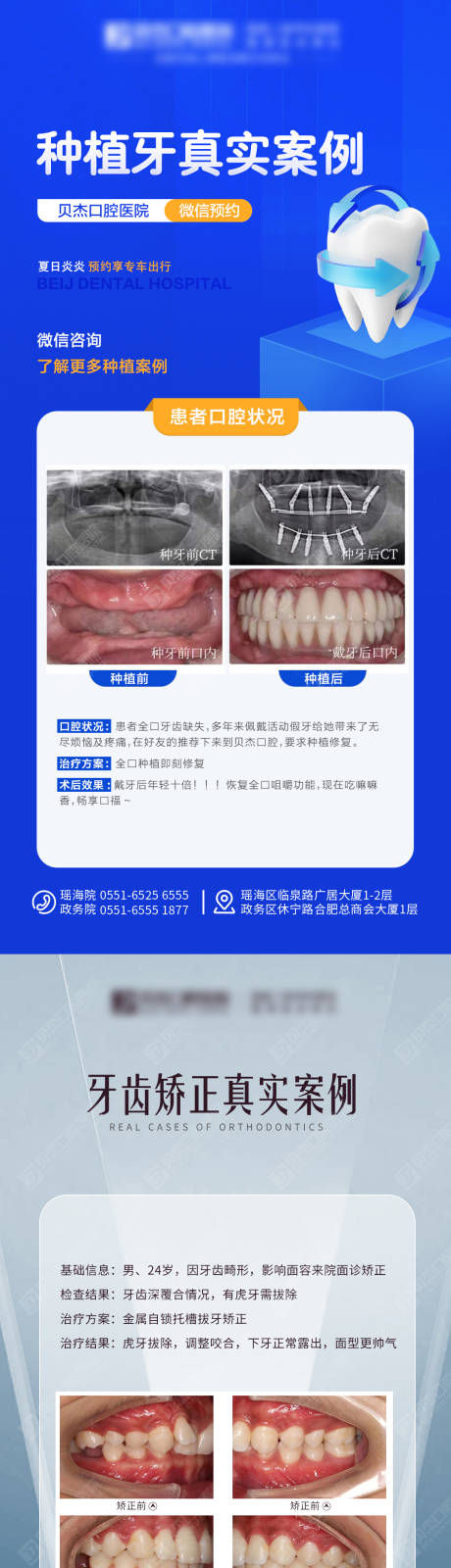 源文件下载【口腔案例海报】编号：20220825183315000