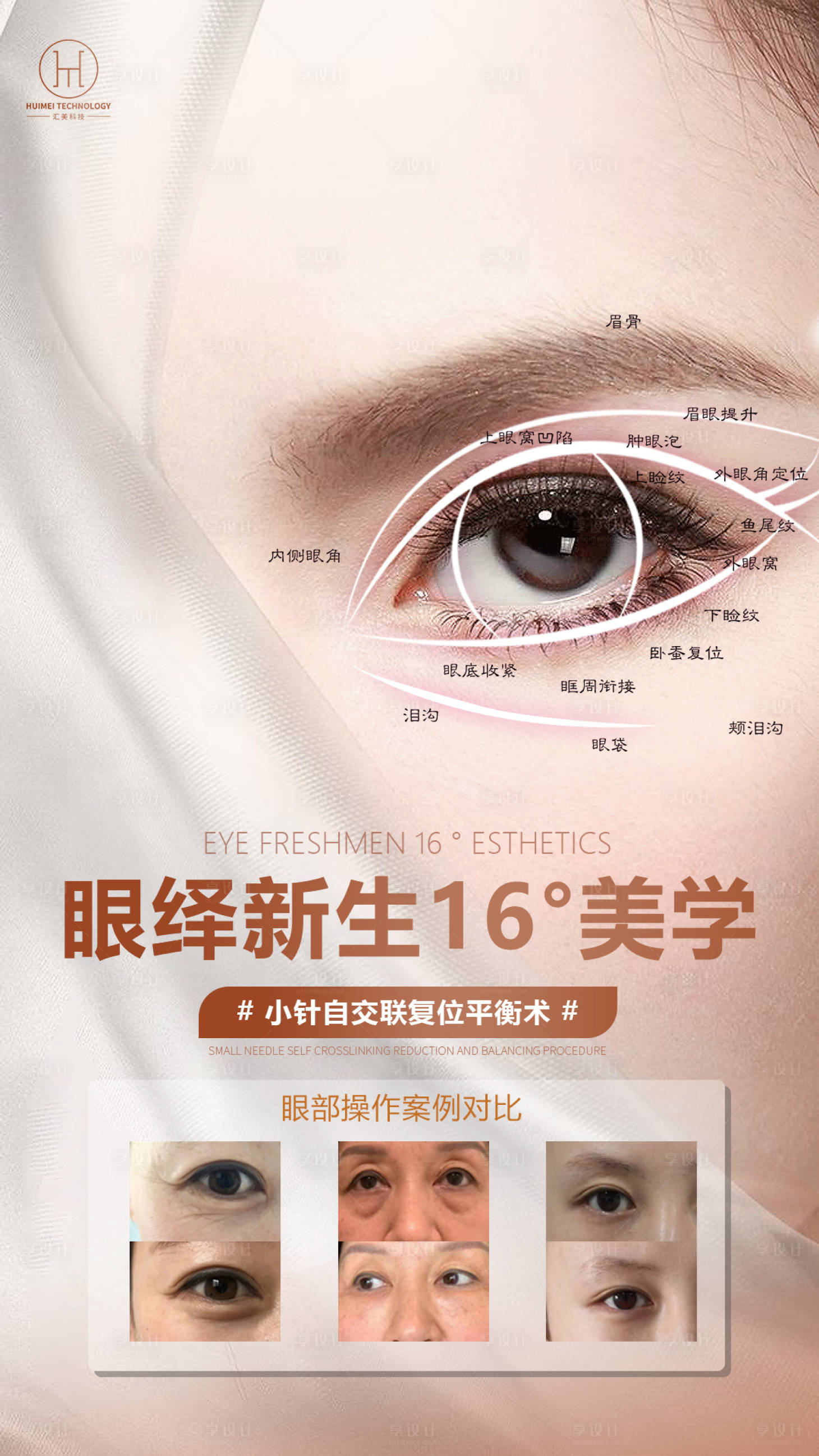 源文件下載【享設計】搜索編號：42240011433605236【醫美眼綜合海報】