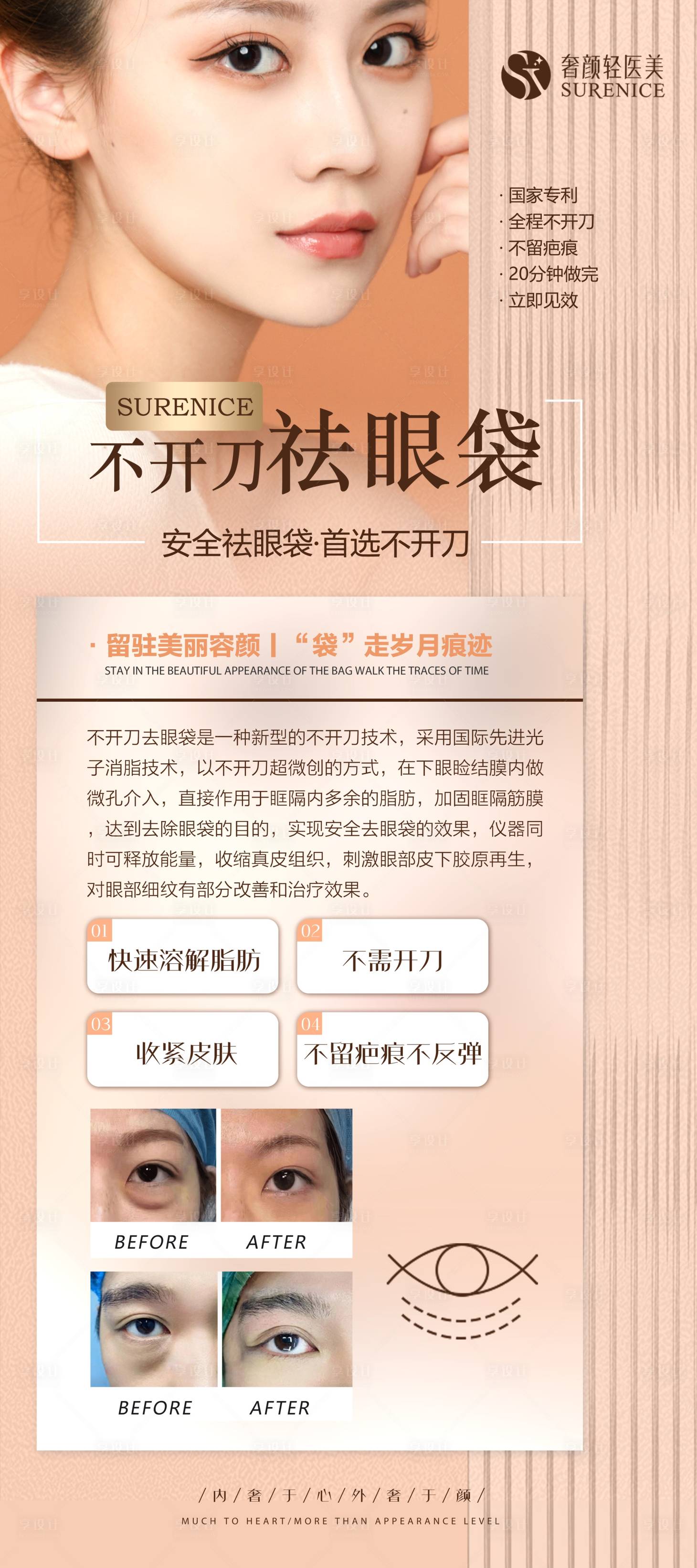 源文件下载【享设计】搜索编号：70750011734915206【医美无痕眼袋展架】