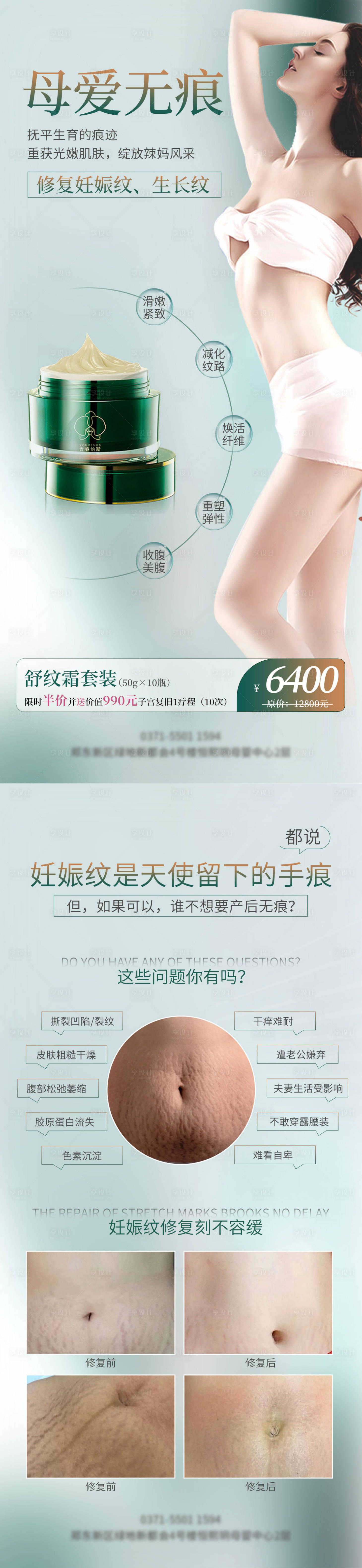源文件下載【享設(shè)計(jì)】搜索編號(hào)：39940011722947595【妊娠紋修復(fù)系列海報(bào)】