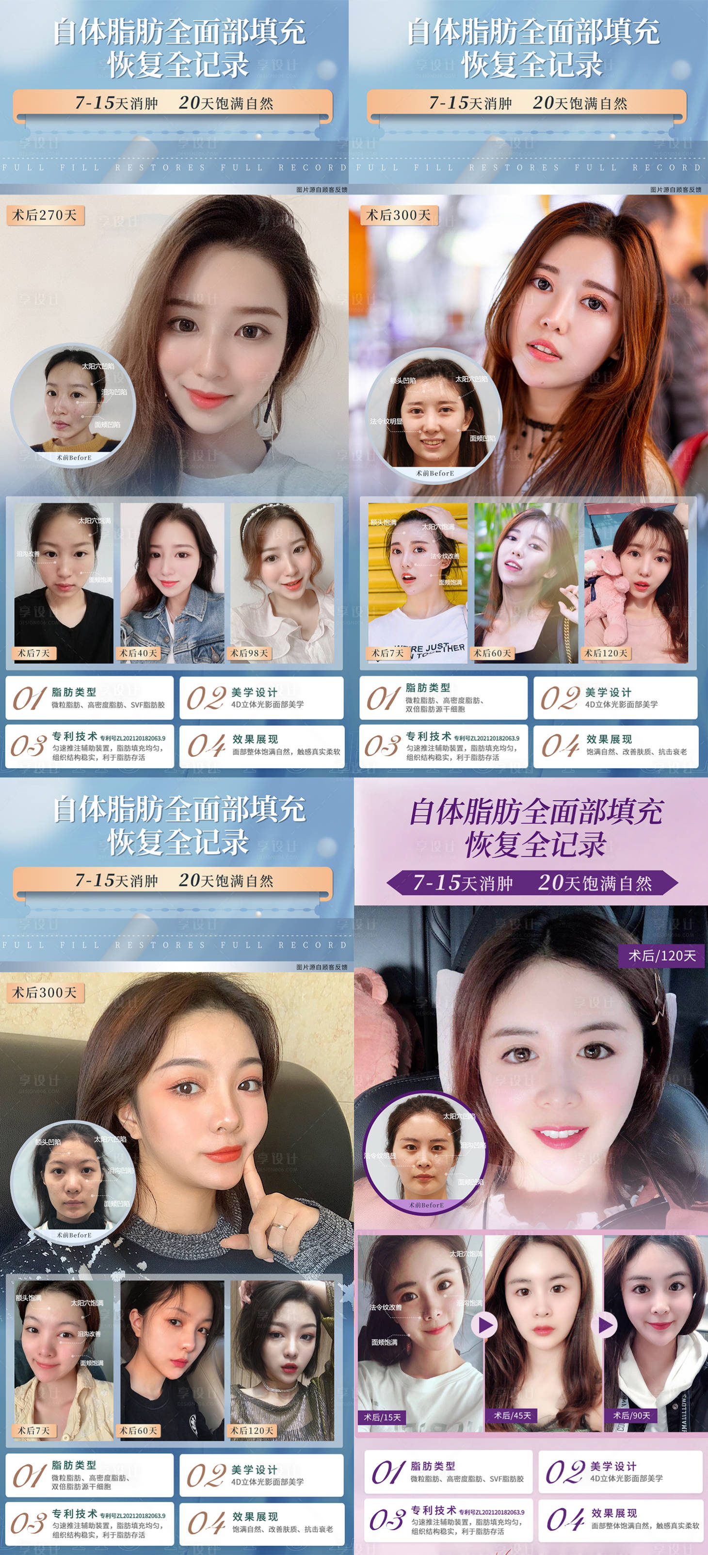 源文件下載【享設計】搜索編號：56790011964647245【面部填充案例醫(yī)美整形人物海報】