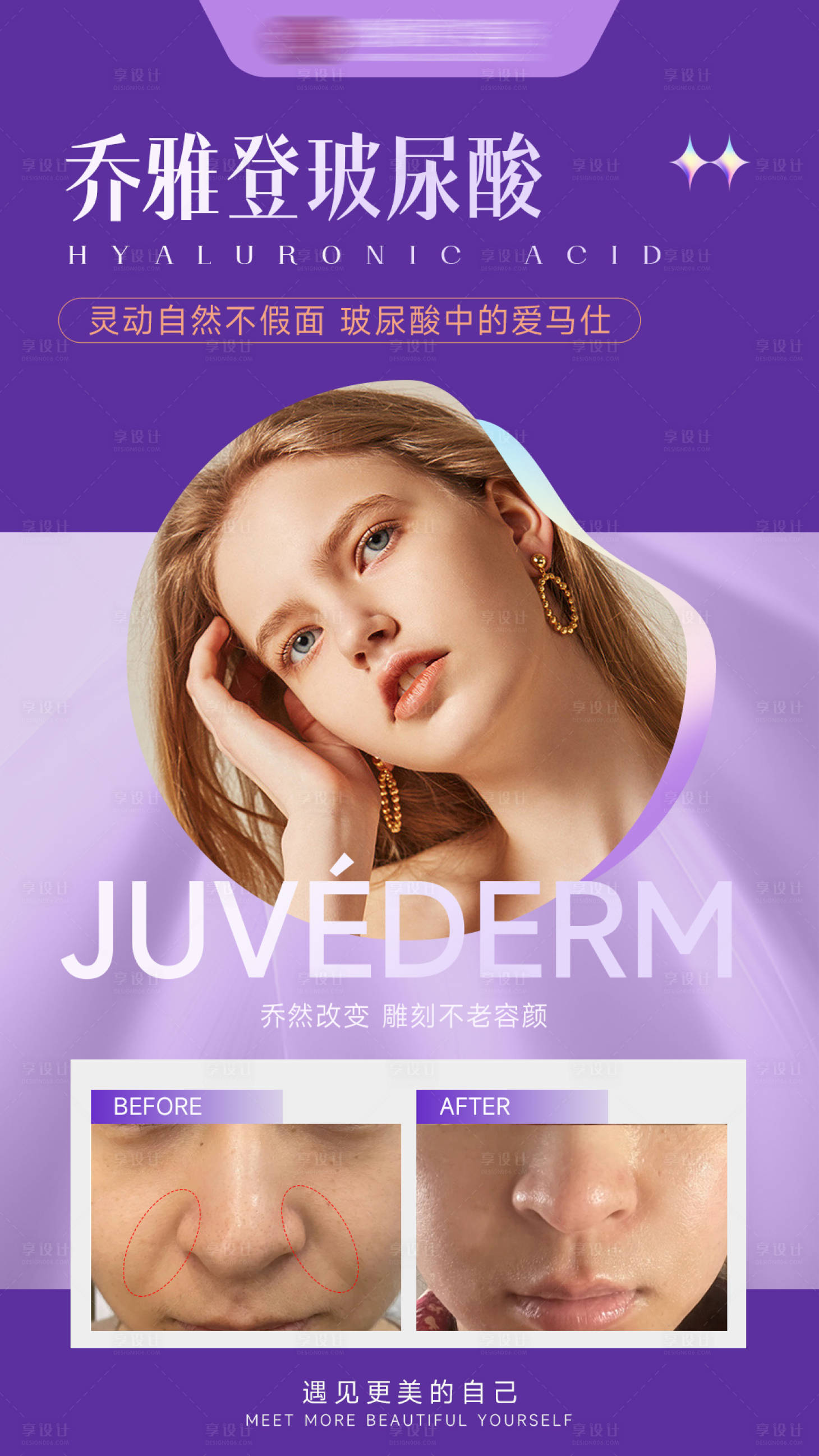 源文件下载【享设计】搜索编号：99050011604677940【医美乔雅登玻尿酸海报】