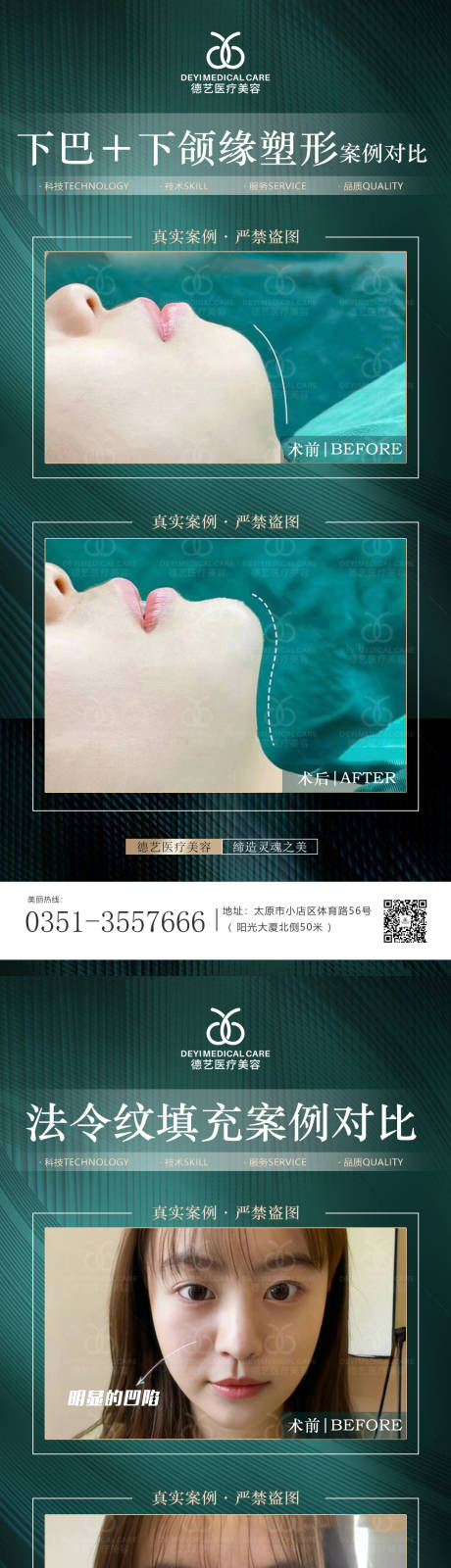 源文件下载【医美案例对比海报】编号：87370011647601823