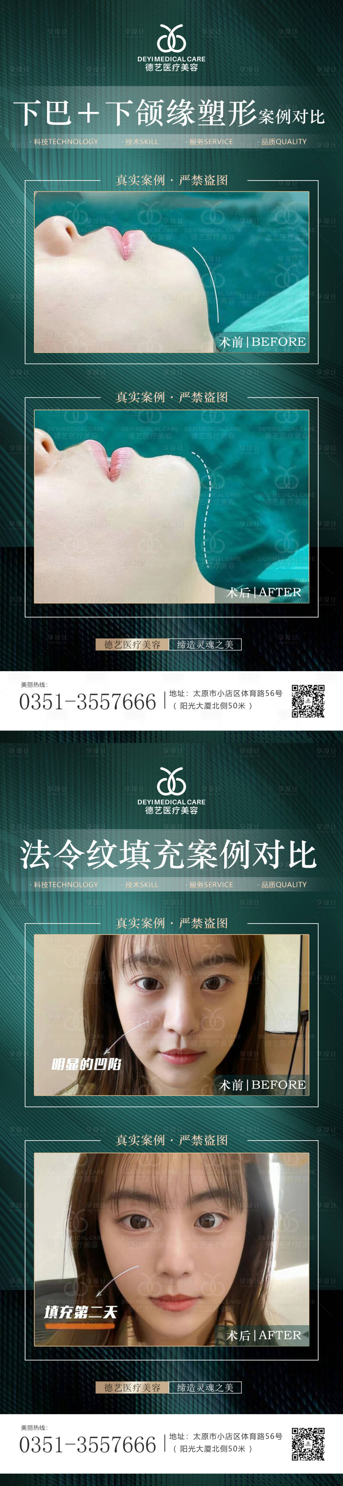 源文件下载【医美案例对比海报】编号：87370011647601823