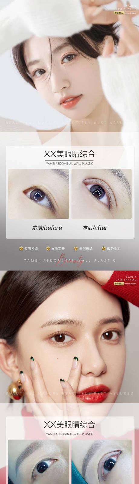 源文件下载【医美案例眼睛系列海报】编号：49920011696517141