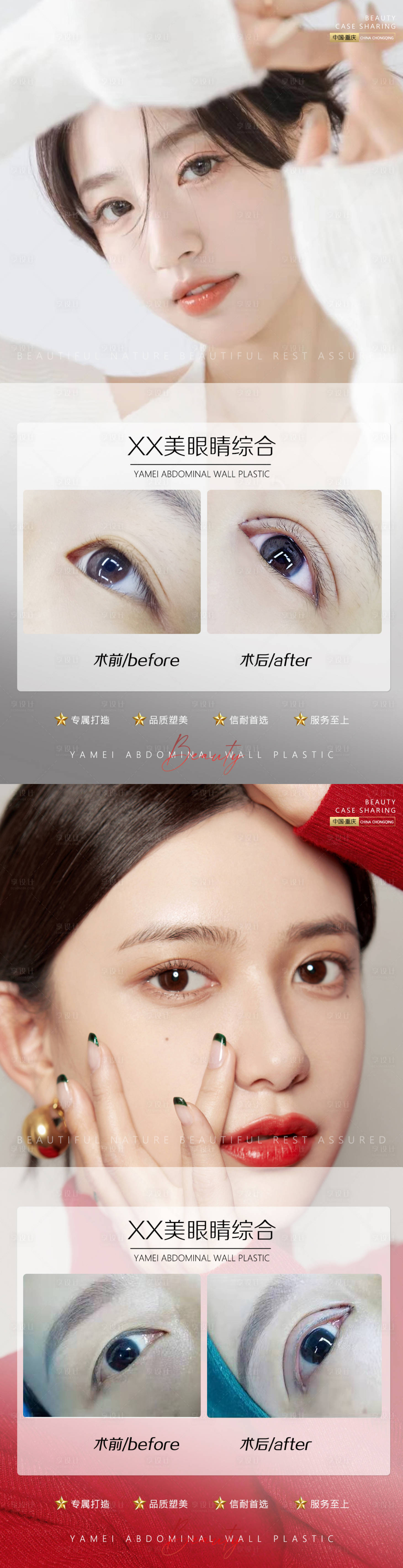 源文件下載【享設計】搜索編號：49920011696517141【醫美案例眼睛系列海報】