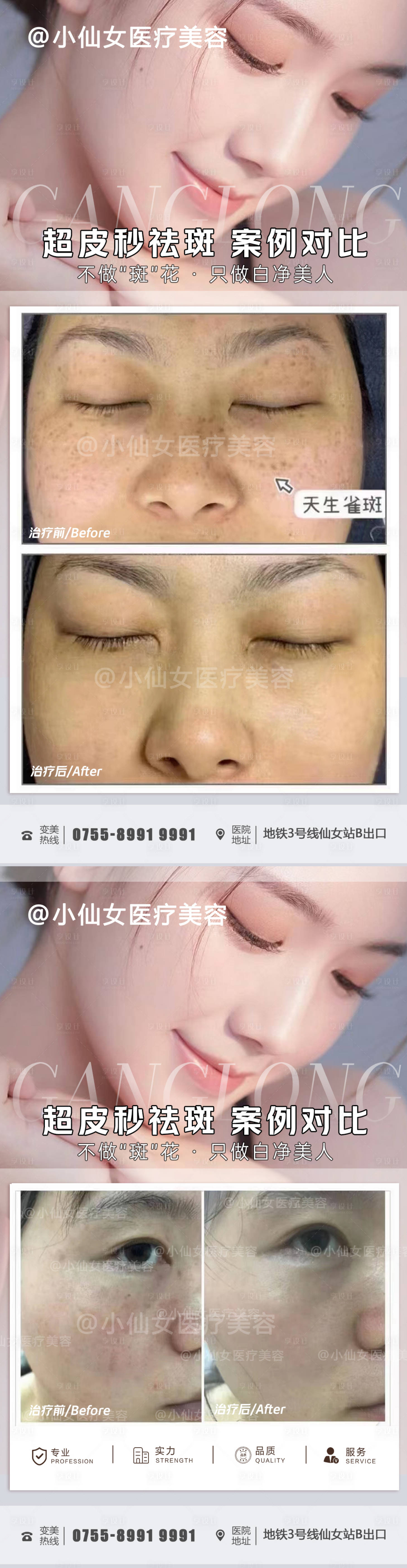 源文件下載【享設計】搜索編號：77070011680513013【醫美超皮秒案例對比】