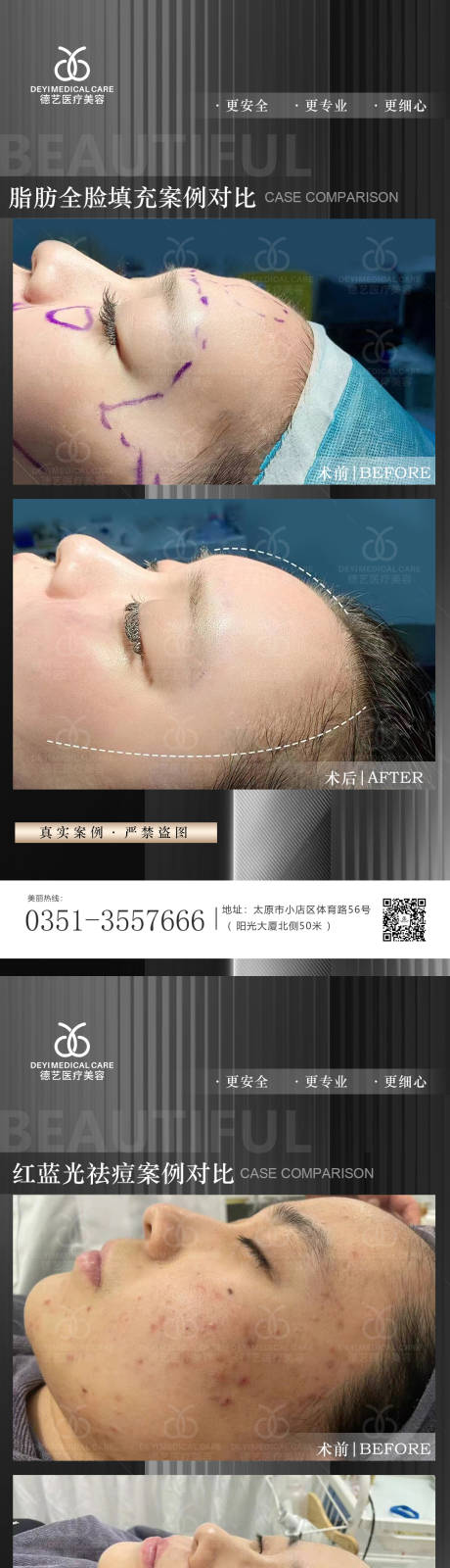 源文件下载【医美案例对比图】编号：13560011654461263