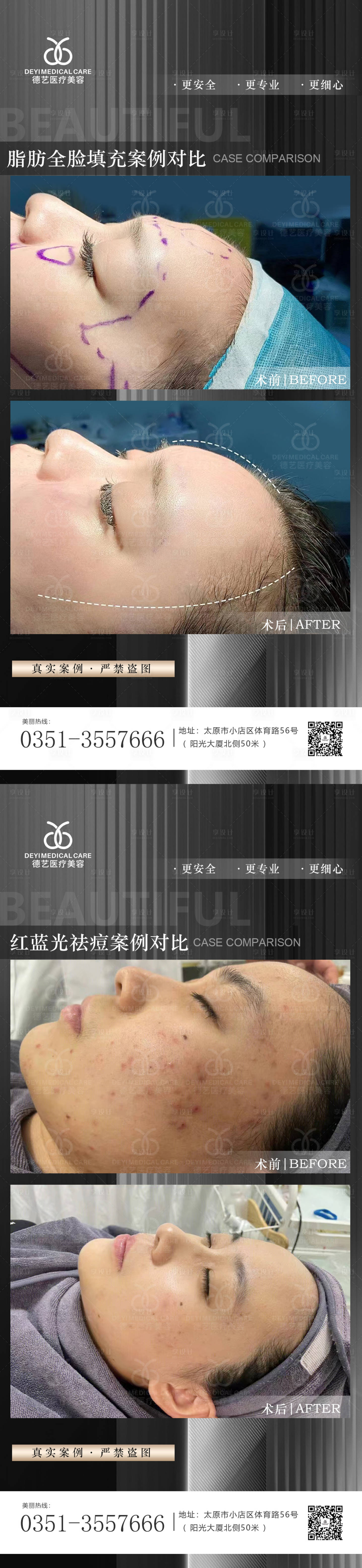 源文件下载【享设计】搜索编号：13560011654461263【医美案例对比图】
