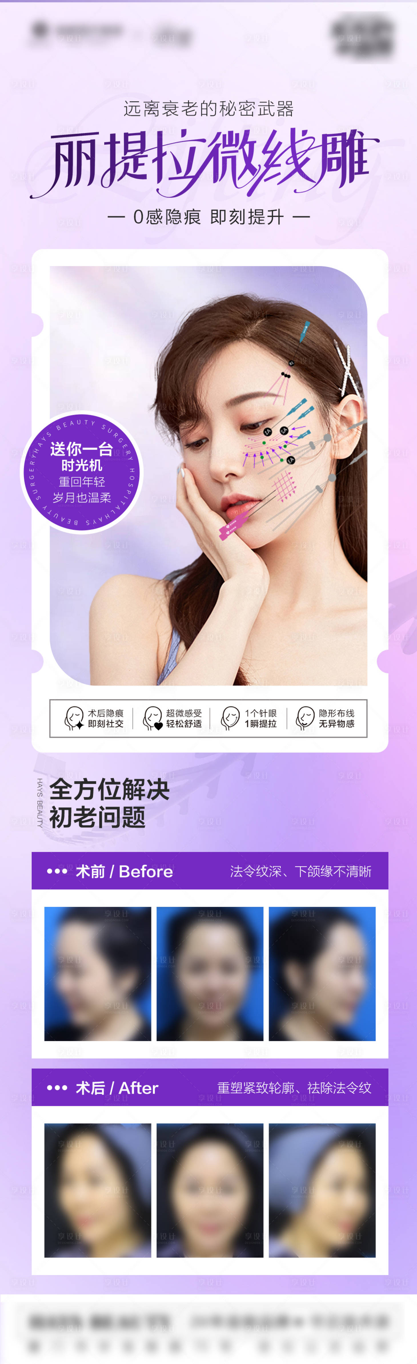 源文件下載【享設計】搜索編號：18700011965769303【醫美線雕魚骨線】