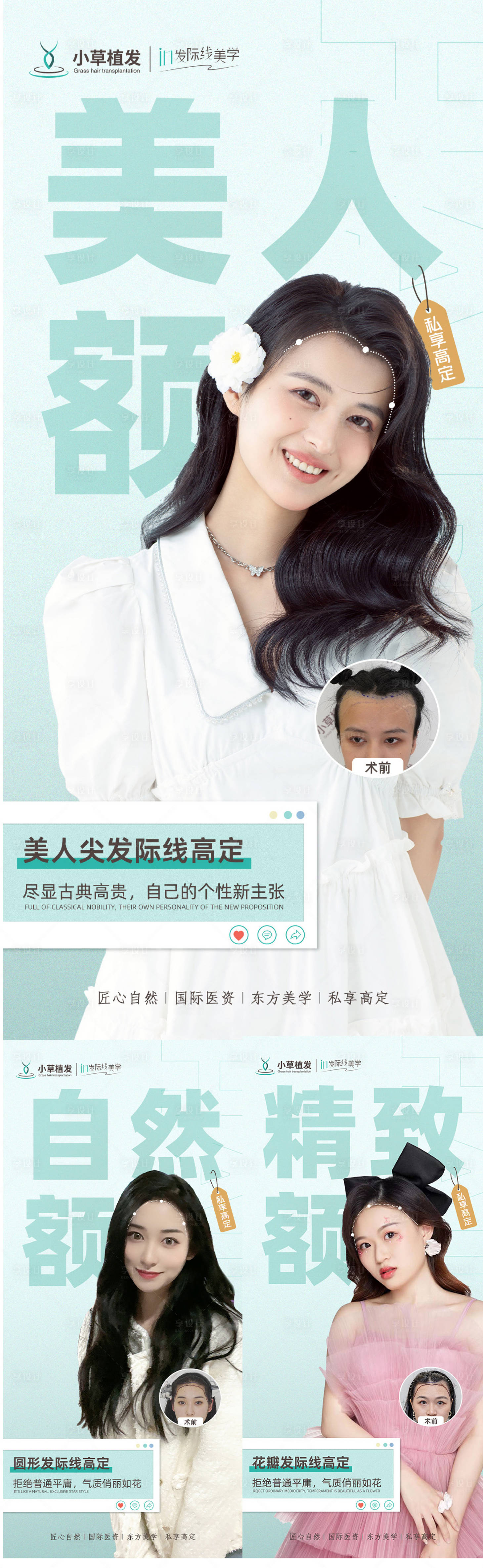 源文件下载【享设计】搜索编号：46530011655922796【医美植发三种额头介绍案例海报】