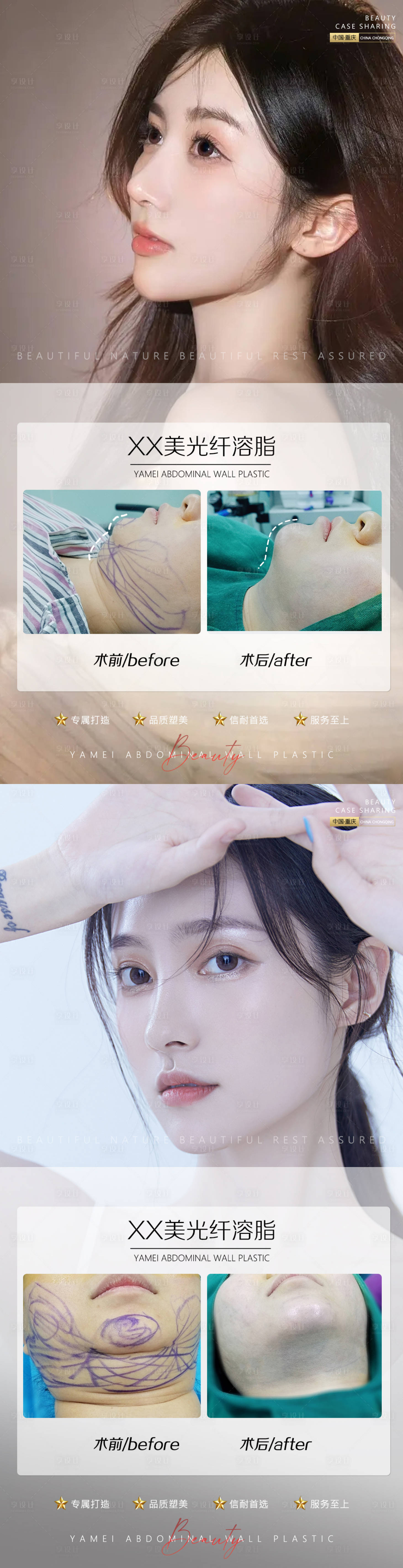 源文件下載【享設計】搜索編號：78960011632252350【醫美案例海報】