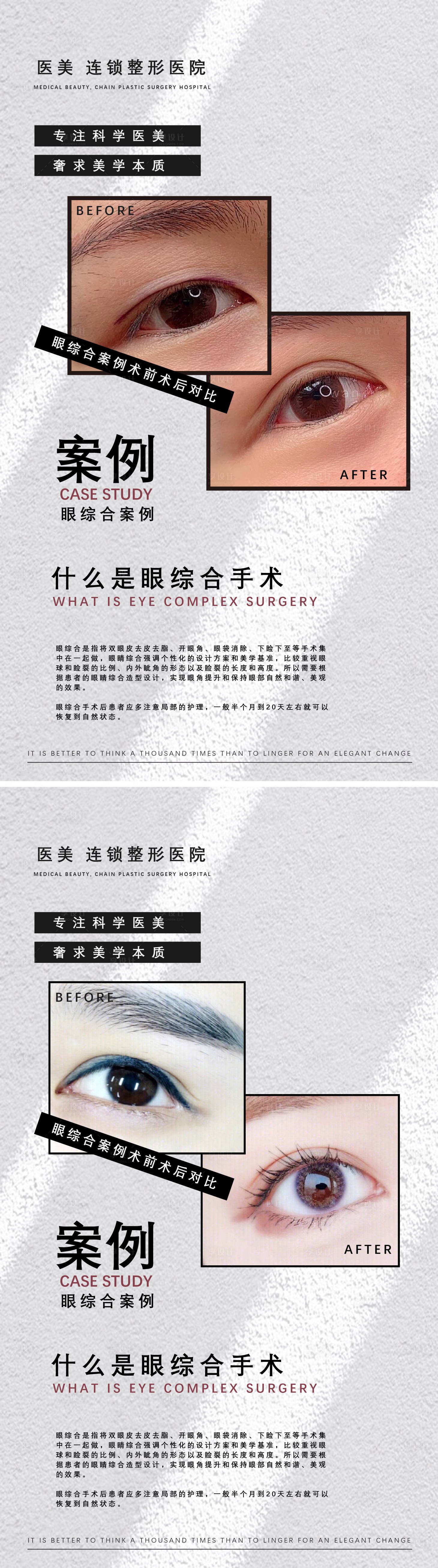 源文件下载【享设计】搜索编号：52060011798323962【医美眼综合案例】